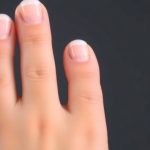 Советы по выбору подходящего средства для ухода за ногтями при грибковой инфекции