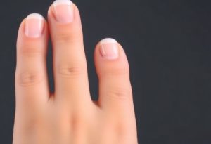 Советы по выбору подходящего средства для ухода за ногтями при грибковой инфекции